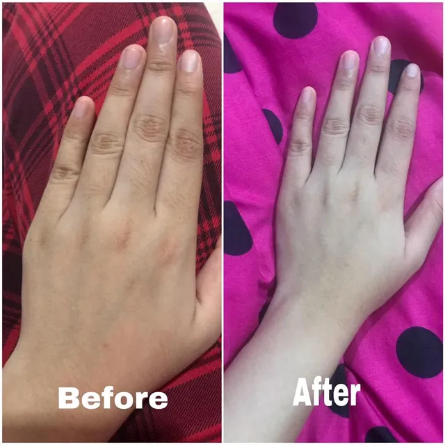 Gambar sebelum dan selepas pelanggan Beauty Dust