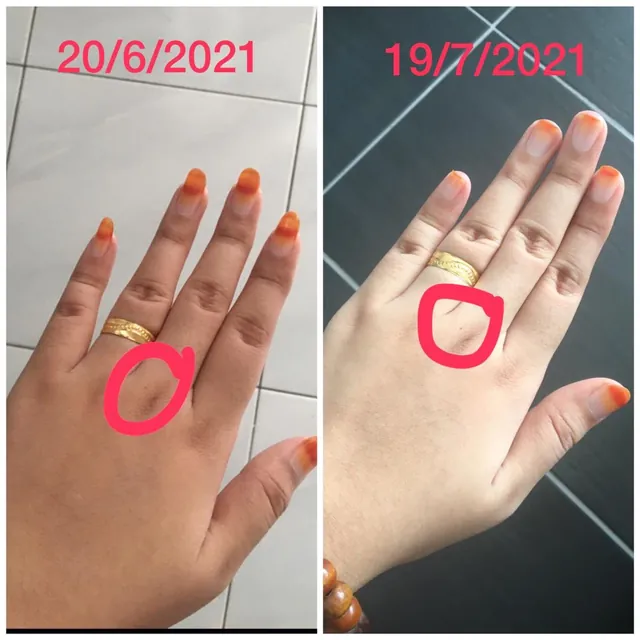Gambar sebelum dan selepas pelanggan Beauty Dust