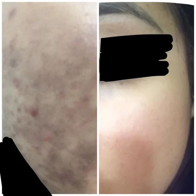Gambar sebelum dan selepas pelanggan Beauty Dust