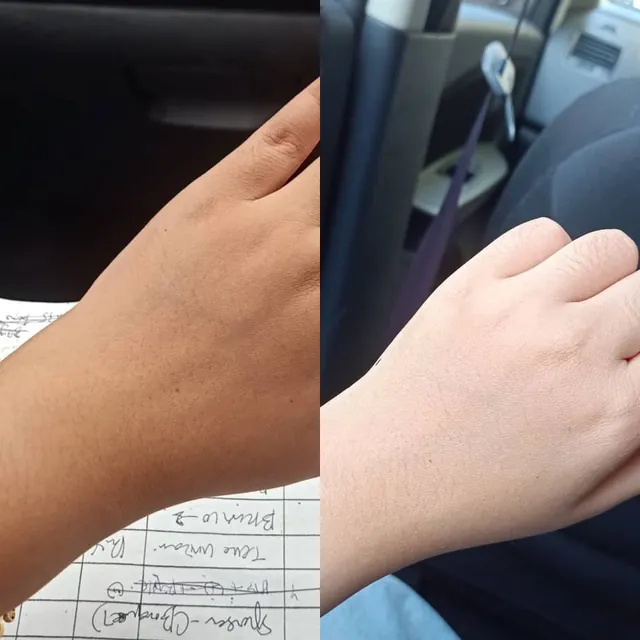 Gambar sebelum dan selepas pelanggan Beauty Dust